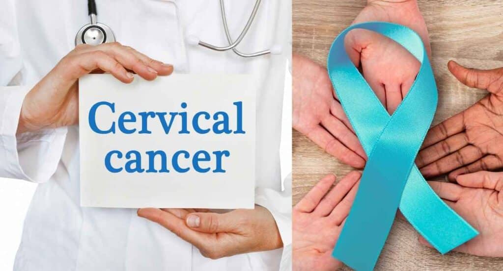 Cervical cancer Image