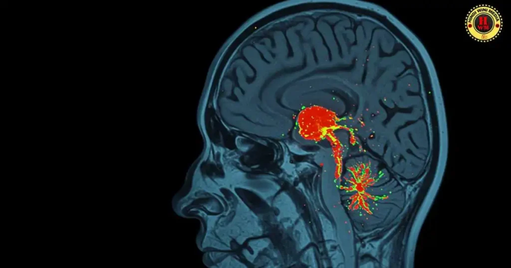MRI scan showing brain activity during Vipassana meditation